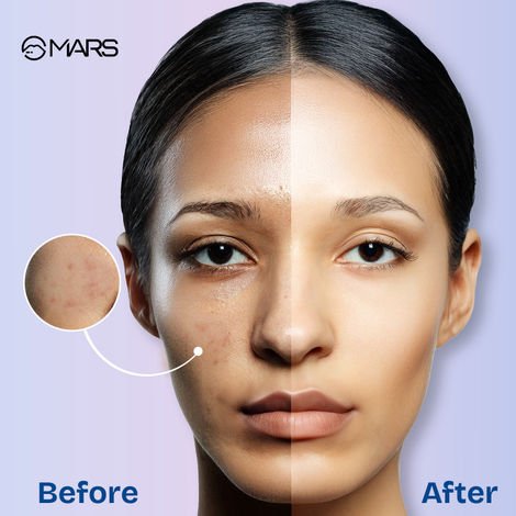 MARS Oil Blotter Gel Compact for Poreless Matte Finish | Oil Control | 5 g - Image 8